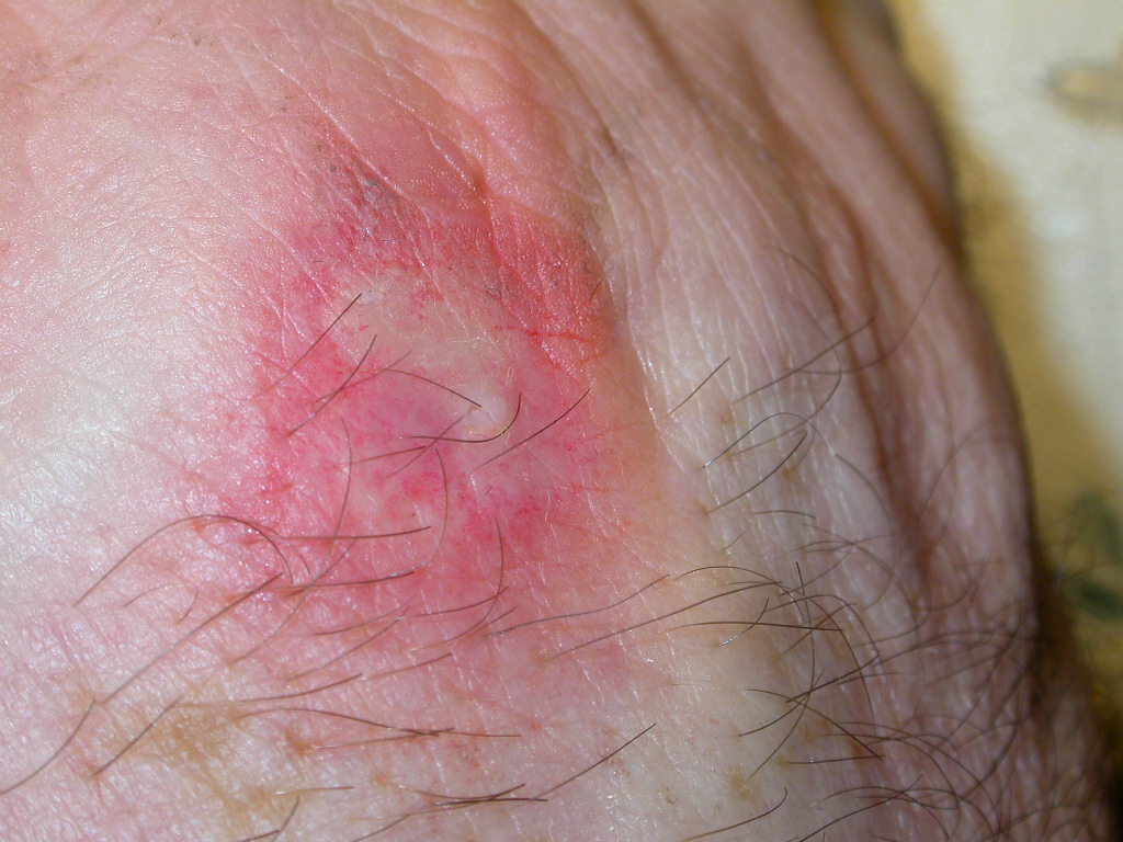 A proposito di morsi....